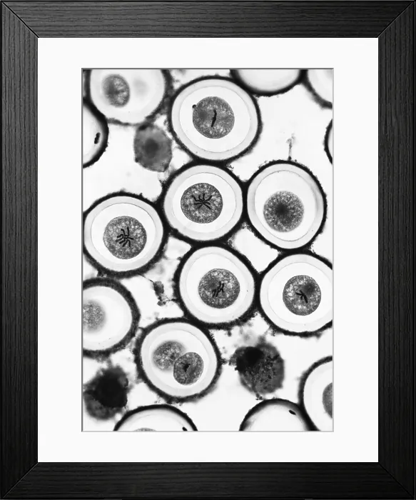 Framed Print : Roundworm mitosis Framed Print : Roundworm mitosis
