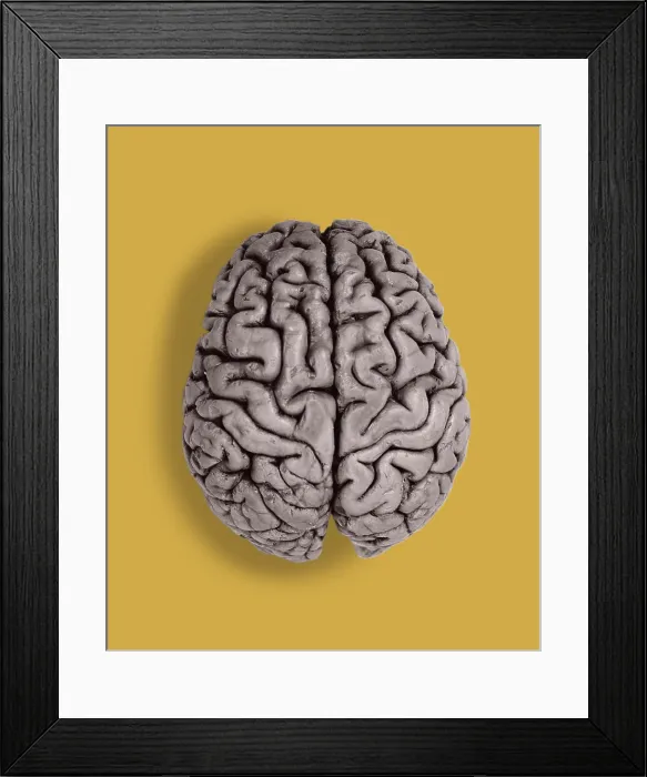 Framed Print : Human Brain, gross specimen Framed Print : Human Brain, gross specimen