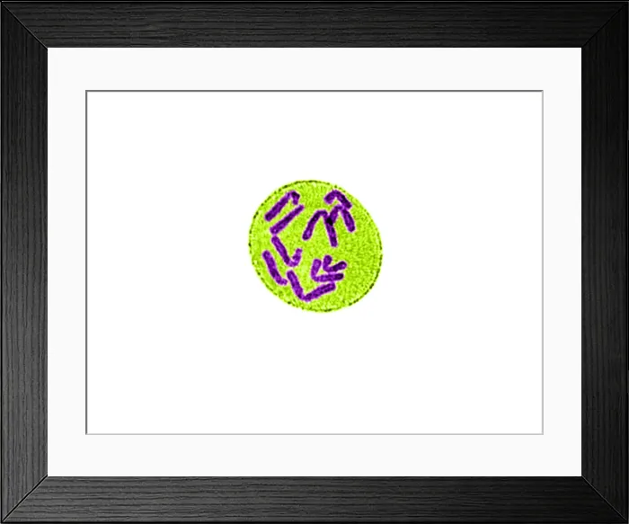 Framed Print : Anaphase of Mitosis in Trillium erectum Framed Print : Anaphase of Mitosis in Trillium erectum
