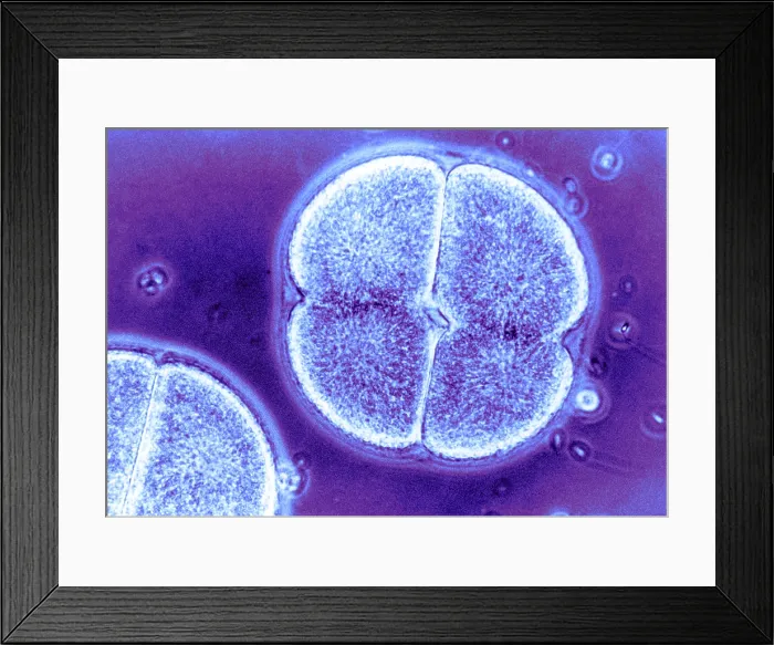 Framed Print : Cell Division, Arbacia Punctulata, light micrograph