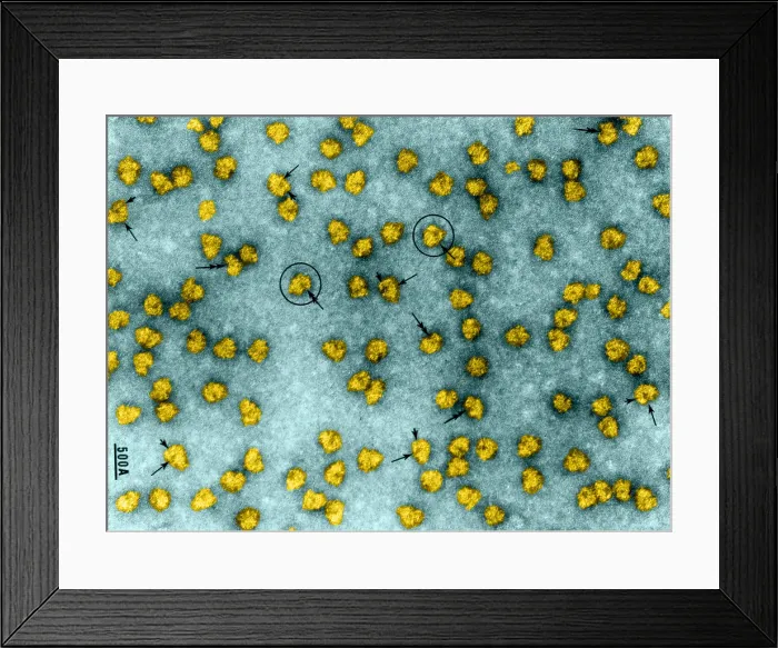 Framed Print : Cell Structure, Ribosomes, TEM Framed Print : Cell Structure, Ribosomes, TEM