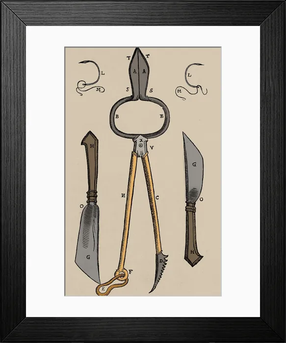 Framed Print : Tagliacozzi Rhinoplasty Method Equipment Framed Print : Tagliacozzi Rhinoplasty Method Equipment