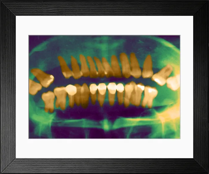 Framed Print : Panoramic Dental X-Ray Framed Print : Panoramic Dental X-Ray