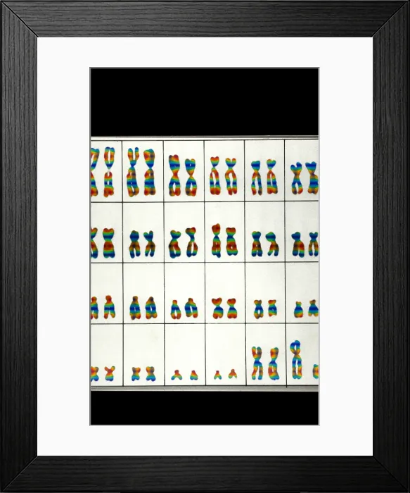 Framed Print : Karyotype, Normal Male Chromosomes Framed Print : Karyotype, Normal Male Chromosomes