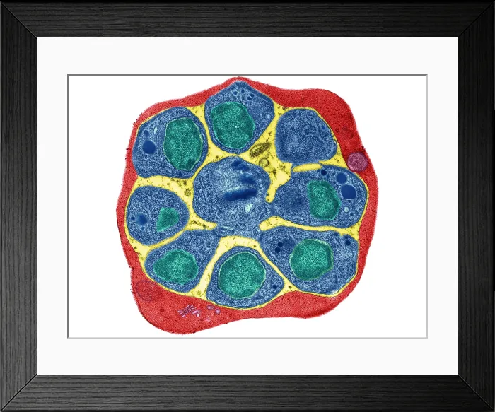 Framed Print : RBC Infected with Malarial Parasite, TEM