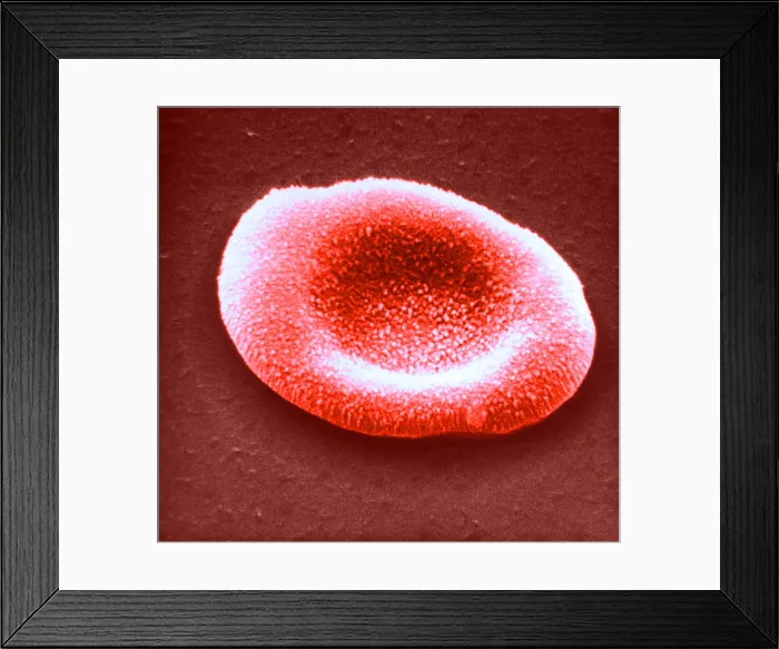 Framed Print : Red Blood Cell, under a microscope (SEM) Framed Print : Red Blood Cell, under a microscope (SEM)