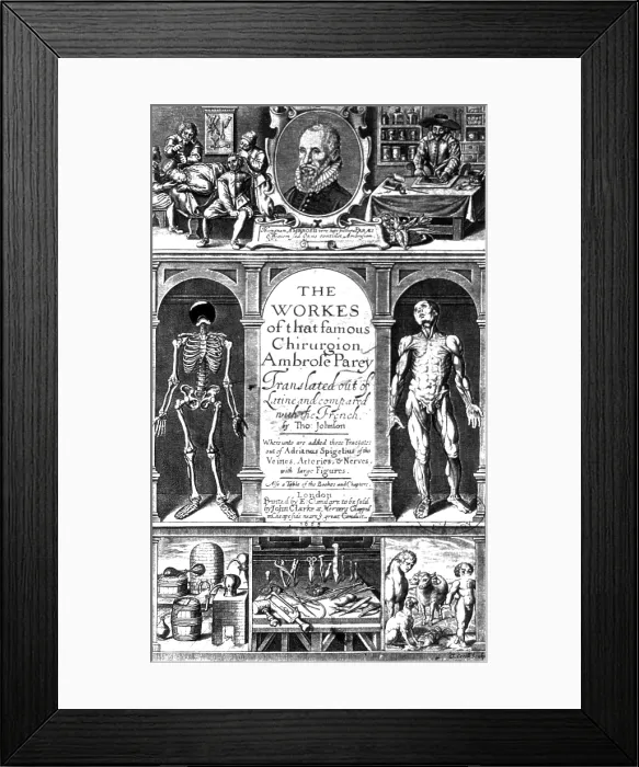 Framed Print : Workes of That Famous Chirurgion Ambrose Parey Framed Print : Workes of That Famous Chirurgion Ambrose Parey
