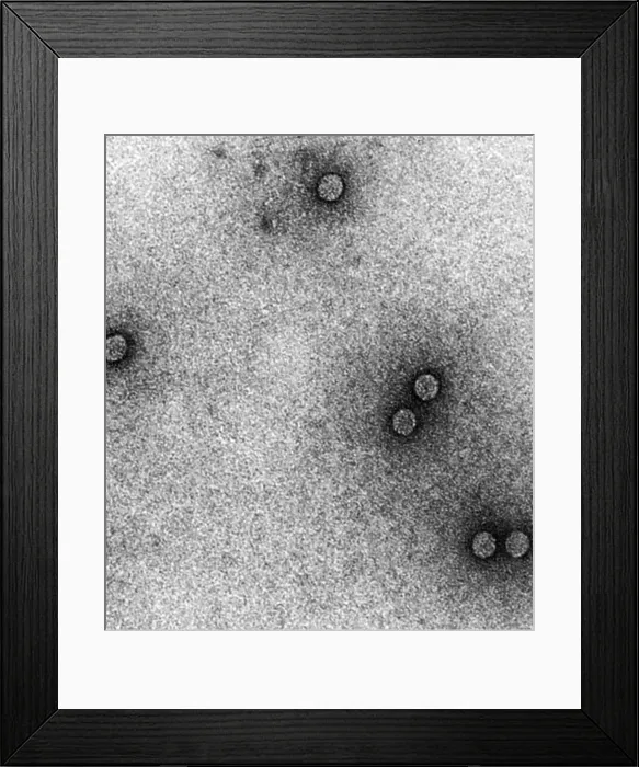 Framed Print : TEM of Rhinoviruses Framed Print : TEM of Rhinoviruses