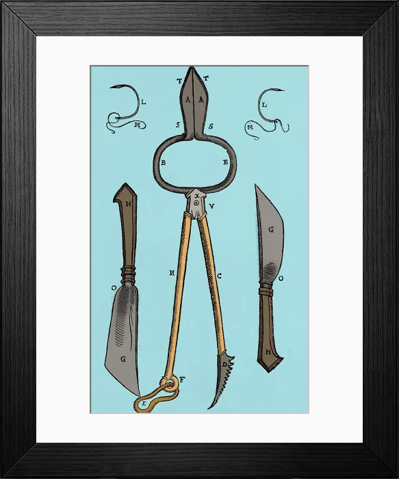 Framed Print : Tagliacozzi Rhinoplasty Method Equipment