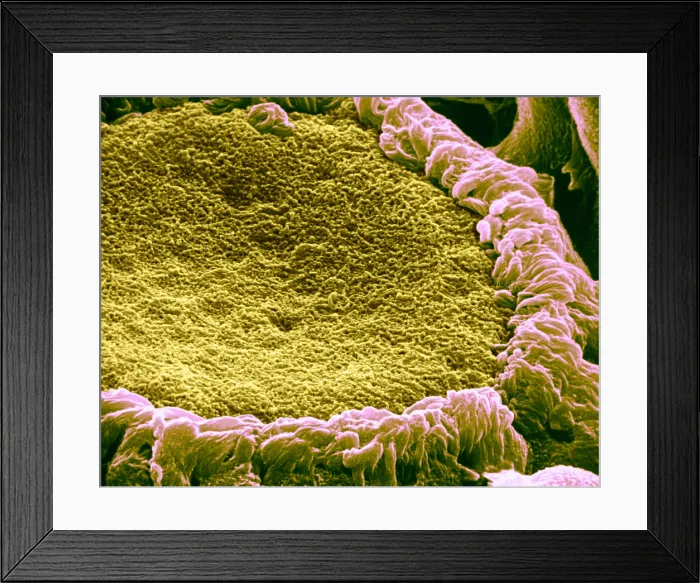 Framed Print : Papilla of frog's tongue, under a microscope (SEM) Framed Print : Papilla of frog's tongue, under a microscope (SEM)