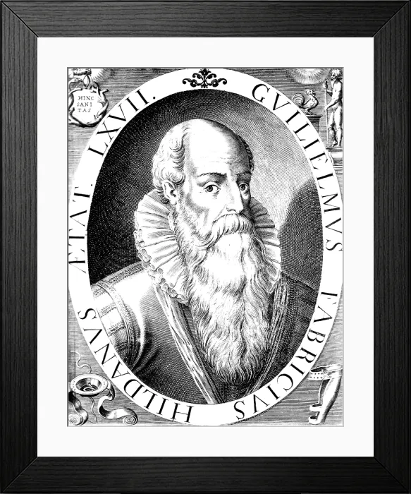 Framed Print : Wilhelm Fabry, German Surgeon Framed Print : Wilhelm Fabry, German Surgeon
