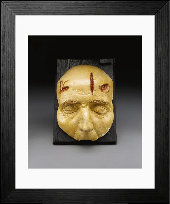 Framed Print : Death Mask, Incision, Laceration and Stab Wounds, 1965 Framed Print : Death Mask, Incision, Laceration and Stab Wounds, 1965