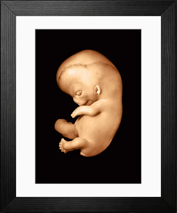 Framed Print : 51 day old human fetus Framed Print : 51 day old human fetus