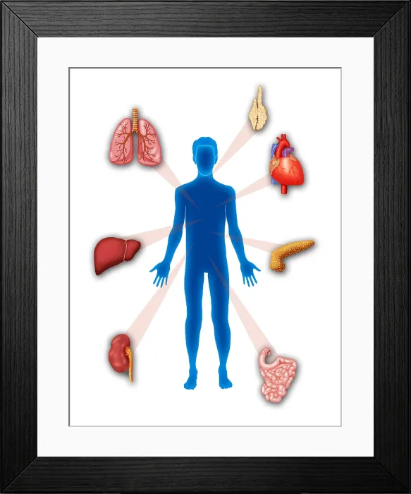 Framed Print : Organ Transplant, Illustration
