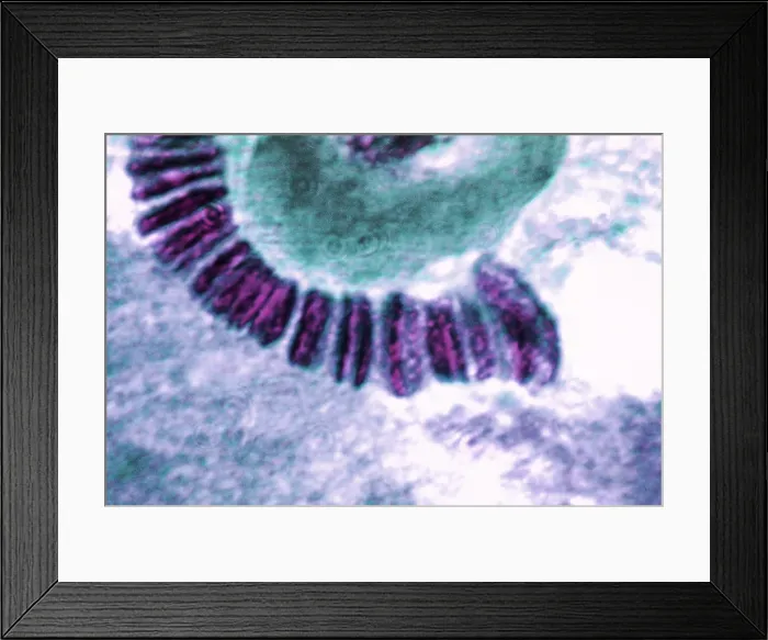 Framed Print : Drosophila chromosome, light micrograph Framed Print : Drosophila chromosome, light micrograph