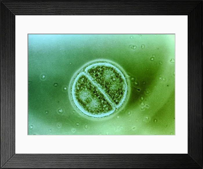 Framed Print : Cell Division in Arbacia Punctulata