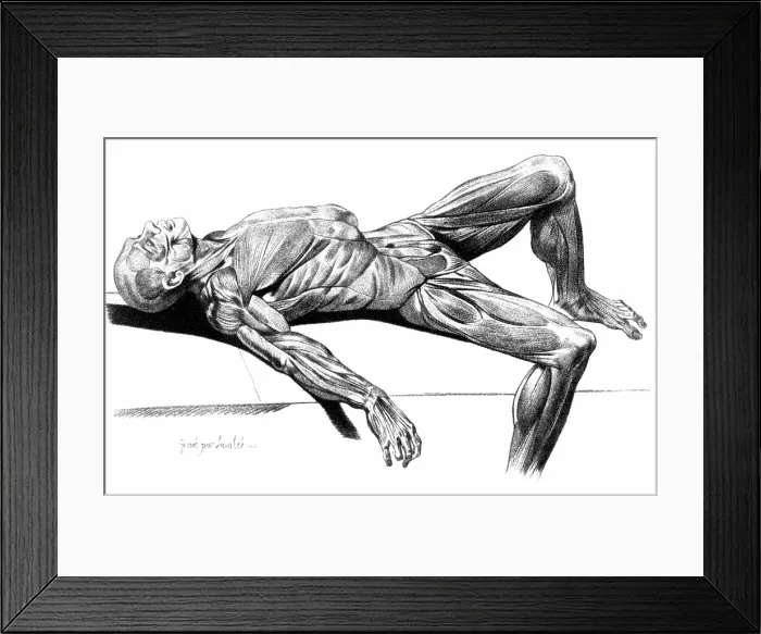 Framed Print : Flayed Cadaver, 1779 Framed Print : Flayed Cadaver, 1779