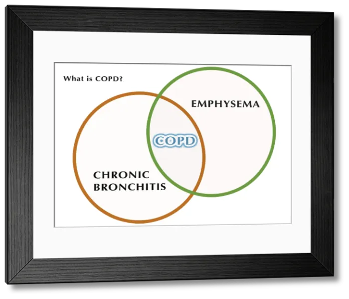 Framed Print : What is COPD? Framed Print : What is COPD?
