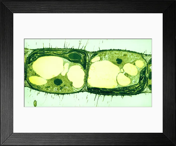 Framed Print : Algae Cell Division, Cylindrocapsa brebissonii Framed Print : Algae Cell Division, Cylindrocapsa brebissonii
