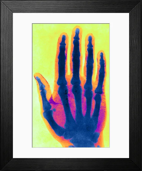 Framed Print : Early X-ray Framed Print : Early X-ray