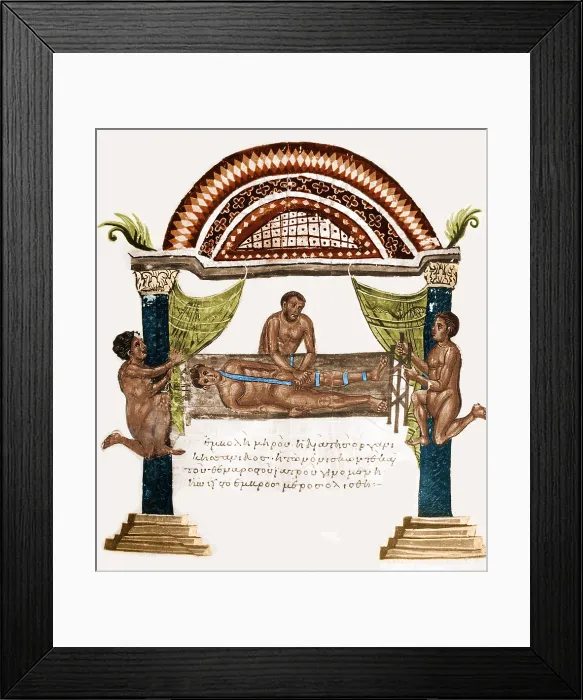 Framed Print : Joint Dislocation Treatment, 1st Century BC Framed Print : Joint Dislocation Treatment, 1st Century BC