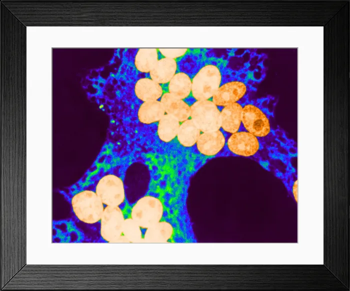 Framed Print : MeV, Measles Virus, TEM Framed Print : MeV, Measles Virus, TEM