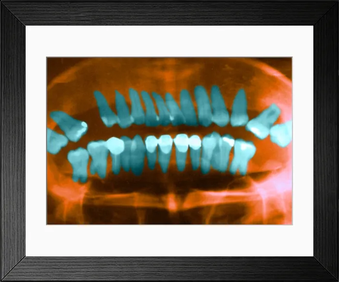 Framed Print : Panoramic Dental X-Ray Framed Print : Panoramic Dental X-Ray