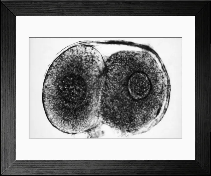 Framed Print : Human Reproduction, Ovum, Zygote Cell Stage, TEM Framed Print : Human Reproduction, Ovum, Zygote Cell Stage, TEM
