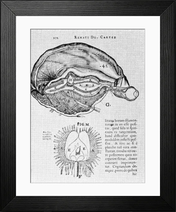 Framed Print : Brain and Pineal Gland Framed Print : Brain and Pineal Gland