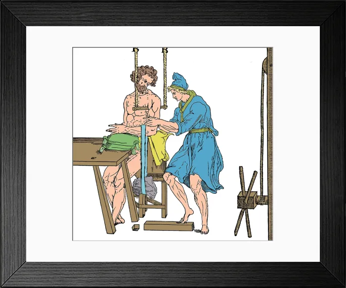 Framed Print : Roman Devices for Setting Fractures