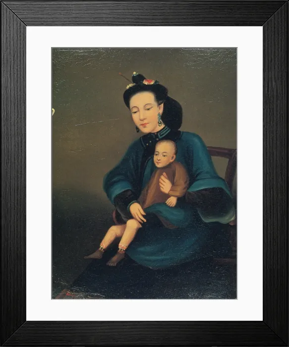 Framed Print : Child with Gangrene Framed Print : Child with Gangrene