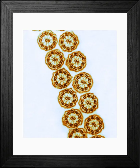 Framed Print : Cilia from Ciliates (TEM)