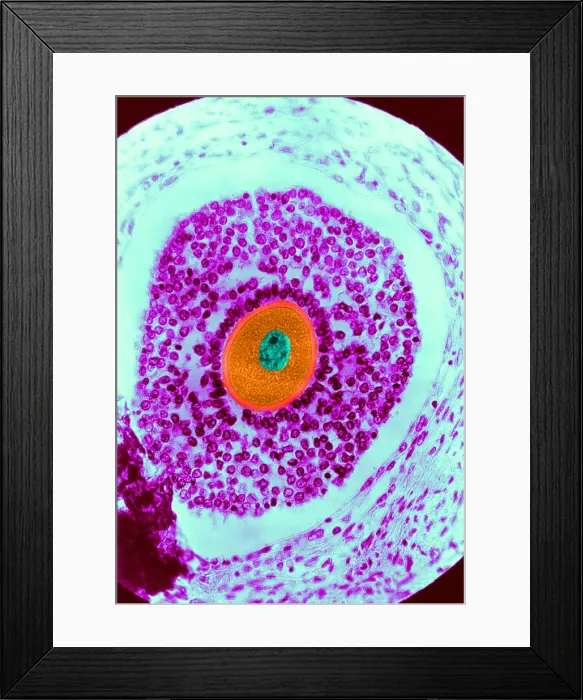 Framed Print : Human Reproduction, Ovum, light micrograph Framed Print : Human Reproduction, Ovum, light micrograph