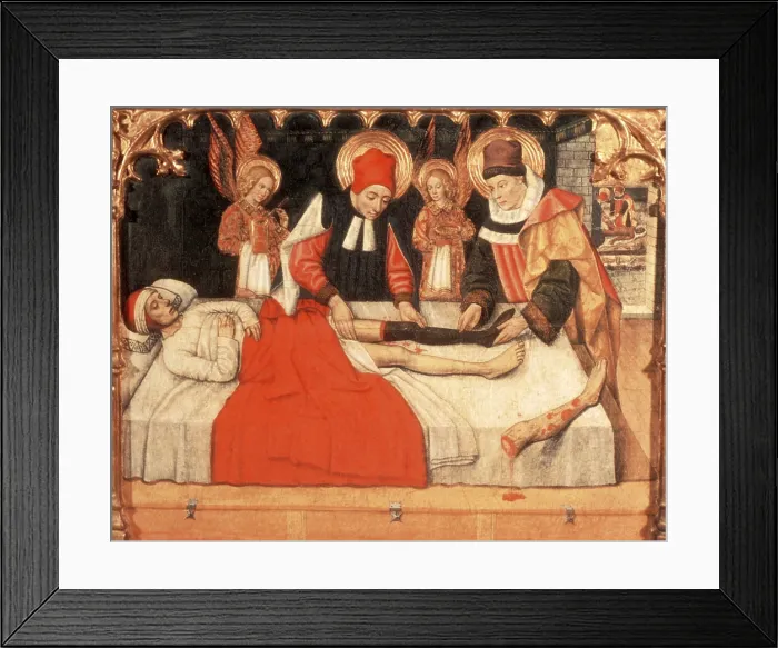 Framed Print : Grafting Leg, 4th Century AD Framed Print : Grafting Leg, 4th Century AD