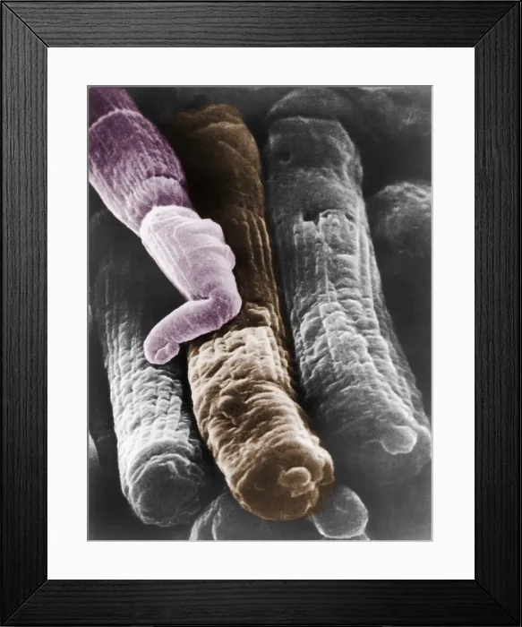 Framed Print : Rods and Cones