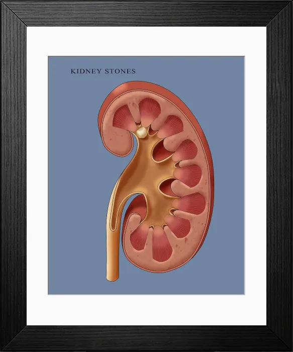 Framed Print : Calyceal Stone, Illustration Framed Print : Calyceal Stone, Illustration