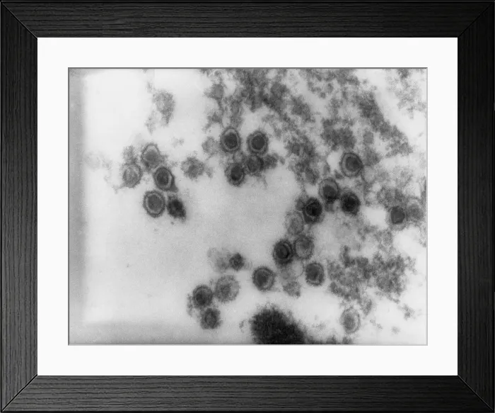 Framed Print : Rauscher Leukemia Virus Framed Print : Rauscher Leukemia Virus