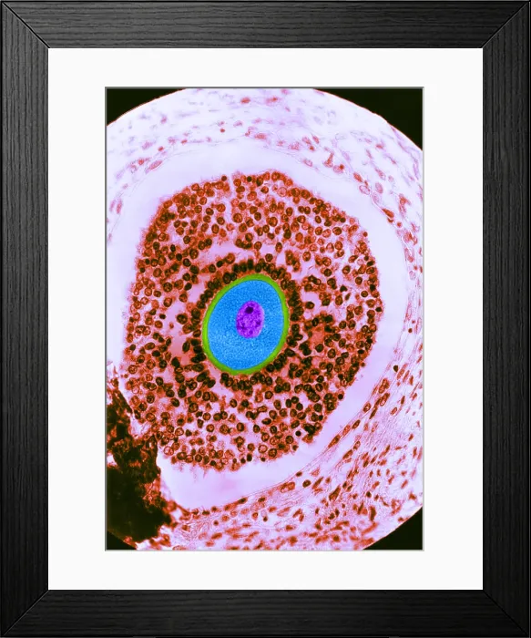 Framed Print : Human Reproduction, Ovum, light micrograph