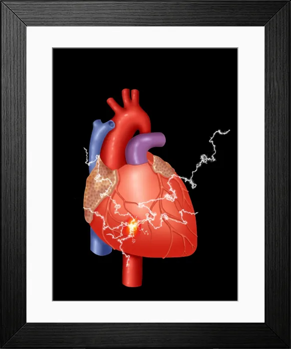 Framed Print : Heart Attack Framed Print : Heart Attack