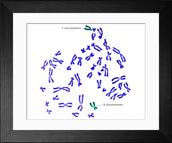 Framed Print : Karyotype, Normal Male Chromosomes Framed Print : Karyotype, Normal Male Chromosomes