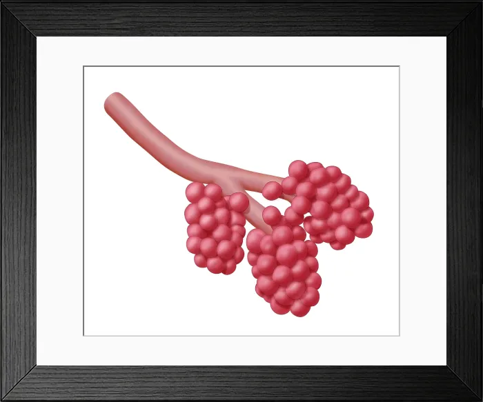 Framed Print : Alveoli. Illustration of alveoli, the small air sacs at the end of the respiratory tree 