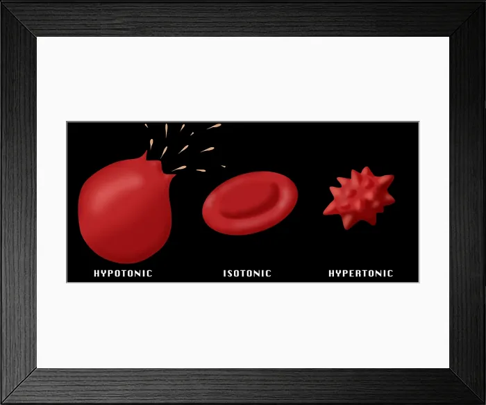Framed Print : Osmotic Pressure on Blood Cells