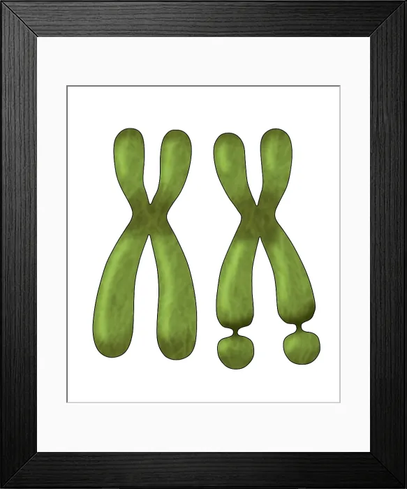 Framed Print : Fragile X Syndrome (FXS) is a genetic condition often associated with autism spectrum disorder (ASD), illustration Framed Print : Fragile X Syndrome (FXS) is a genetic condition often associated with autism spectrum disorder (ASD), illustration
