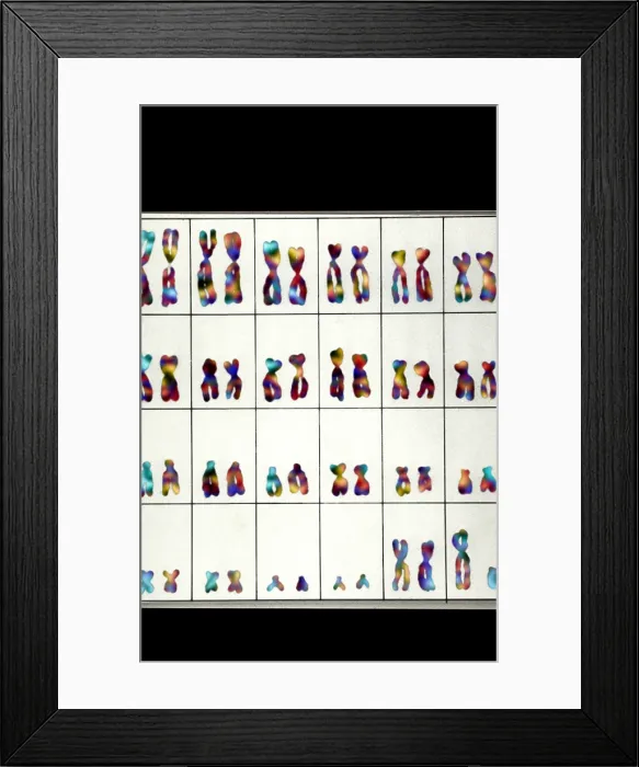 Framed Print : Karyotype, Normal Male Chromosomes Framed Print : Karyotype, Normal Male Chromosomes