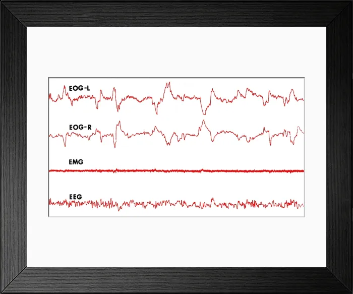 Framed Print : Polygraph Tracings of REM Sleep Framed Print : Polygraph Tracings of REM Sleep