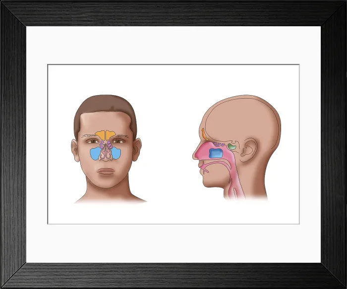 Framed Print : Paranasal sinus anatomy, maxillary, frontal, sphenoid, ethmoid cavities, illustration
