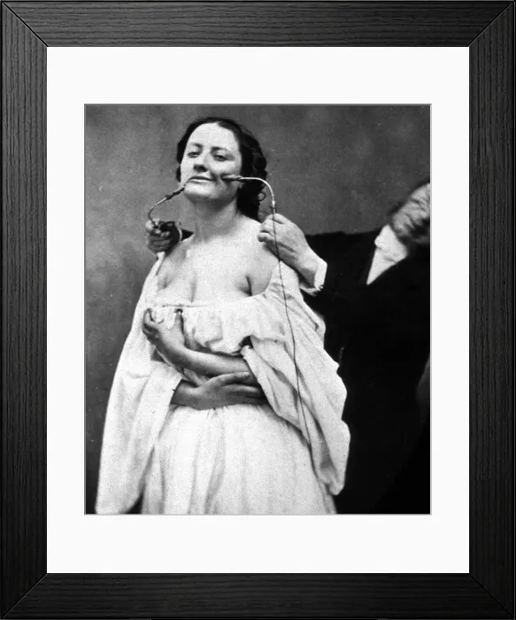 Framed Print : G.B.A. Duchenne Performs Electrotherapy, 1862
