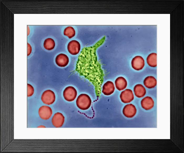 Framed Print : Phagocytosis, WBC Ingesting Streptococcus, light micrograph Framed Print : Phagocytosis, WBC Ingesting Streptococcus, light micrograph