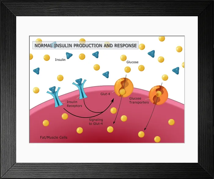 Framed Print : Normal, healthy insulin & glucose production diagram, GLUT4, insulin receptor, medical illustration Framed Print : Normal, healthy insulin & glucose production diagram, GLUT4, insulin receptor, medical illustration