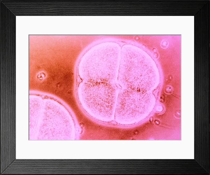 Framed Print : Cell Division, Arbacia Punctulata, light micrograph
